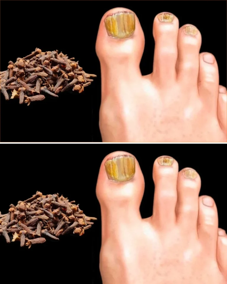 Home treatments for nail fungus remedy using natural ingredients